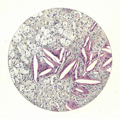 Historic Pathology Art