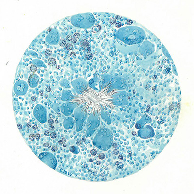 Historic Pathology Art