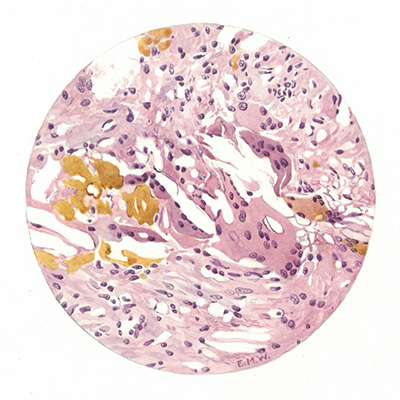 Historic Pathology Art