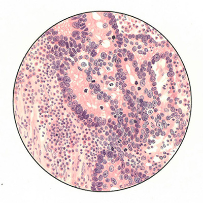 Historic Pathology Art