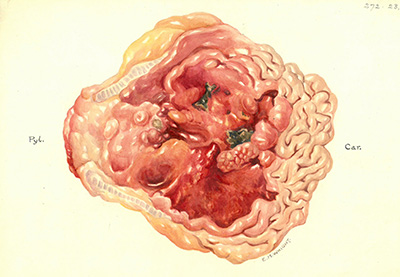 Historic Pathology Art