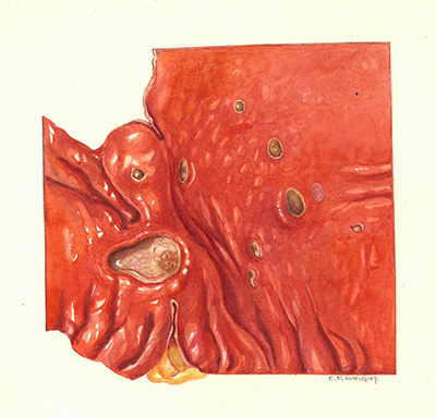 Historic Pathology Art