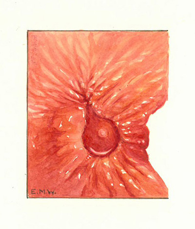 Historic Pathology Art