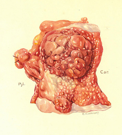 Historic Pathology Art
