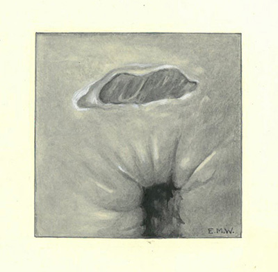 Historic Pathology Art