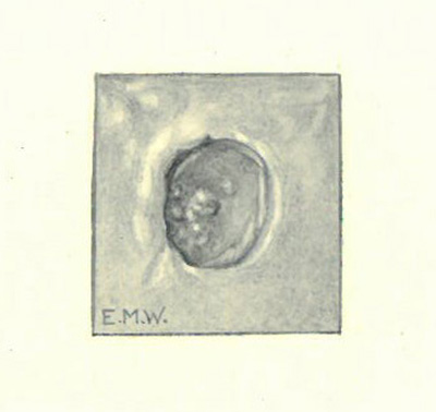 Historic Pathology Art