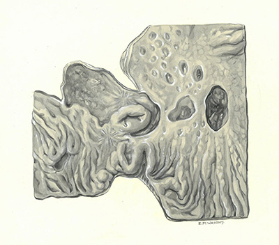 Historic Pathology Art