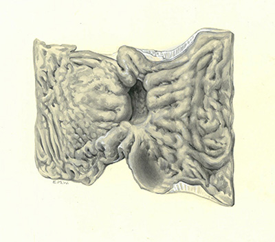 Historic Pathology Art