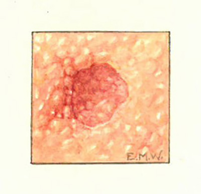 Historic Pathology Art
