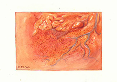 Historic Pathology Art
