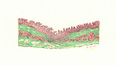 Historic Pathology Art