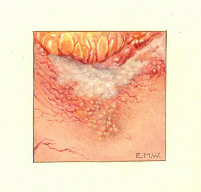 Historic Pathology Art