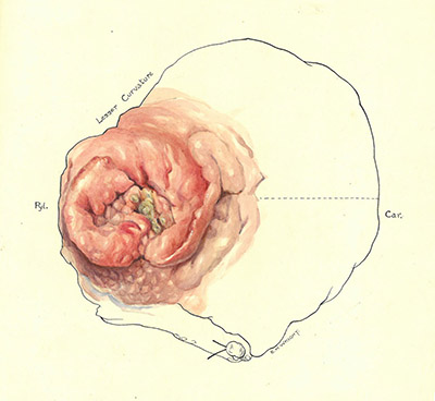 Historic Pathology Art