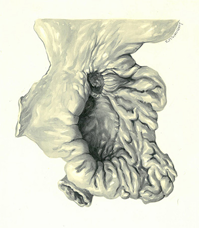 Historic Pathology Art
