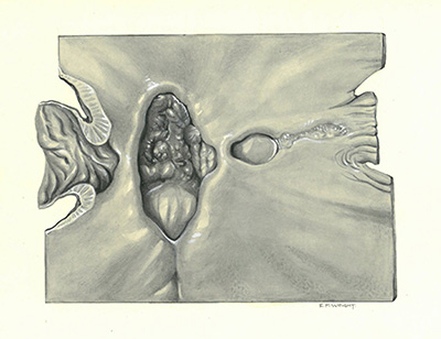 Historic Pathology Art