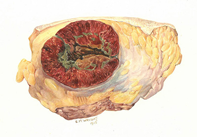 Historic Pathology Art