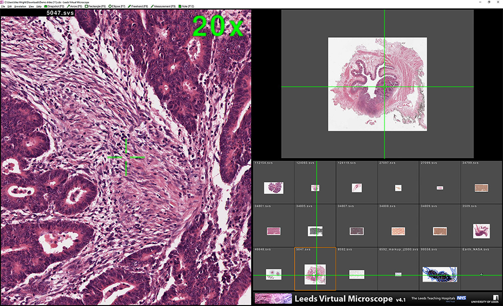 The Leeds Virtual Micoscope (LVM) Viewer