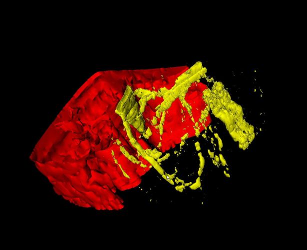 3d View of Liver