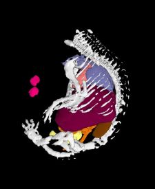 3d View of Mouse Embryo