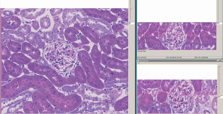 Three registered glomerulus planes