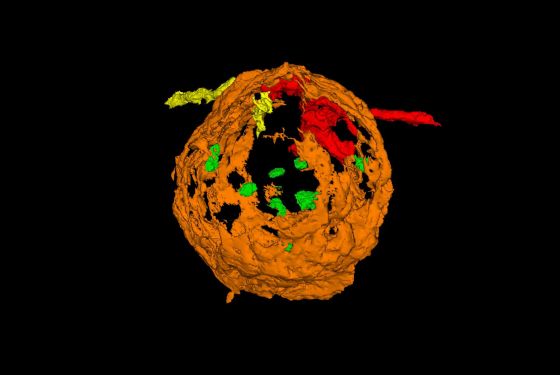 3d View of Glomerulus