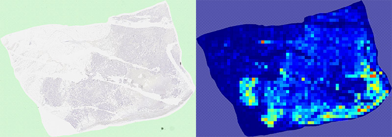Heatmap of cell counts in a whole slide image