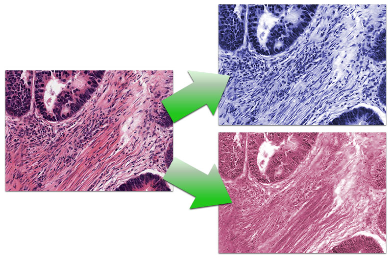 Colour deconvolution on an H&E stained image