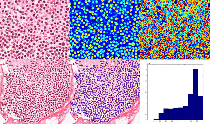 Lymphocyte Cell Detection