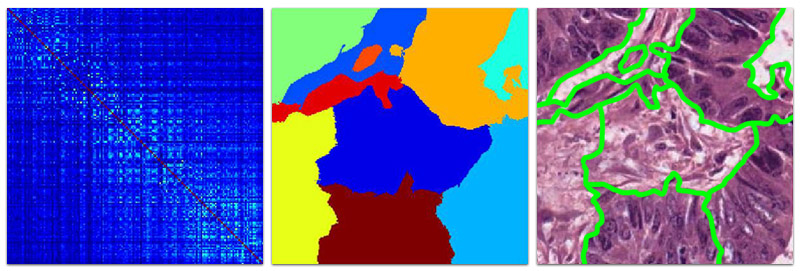 Image analysis - normalised cuts