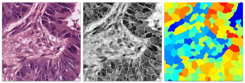 Image analysis - SLIC segmentation