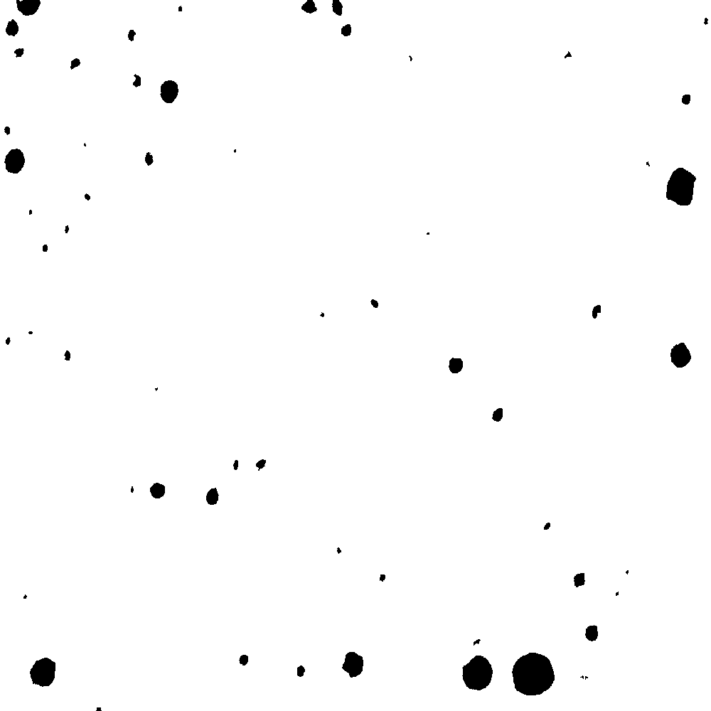 Liver with Fat Globules Detected