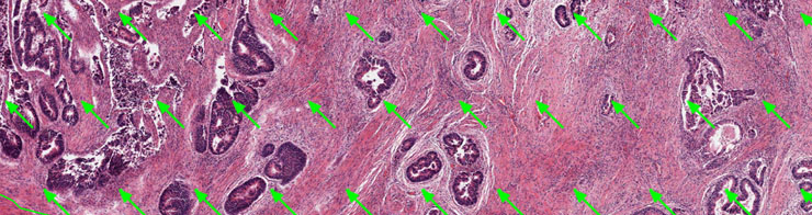 RandomSpot Stereometry