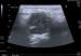 3 CASE4.jpg