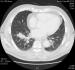 5 CASE6.jpg